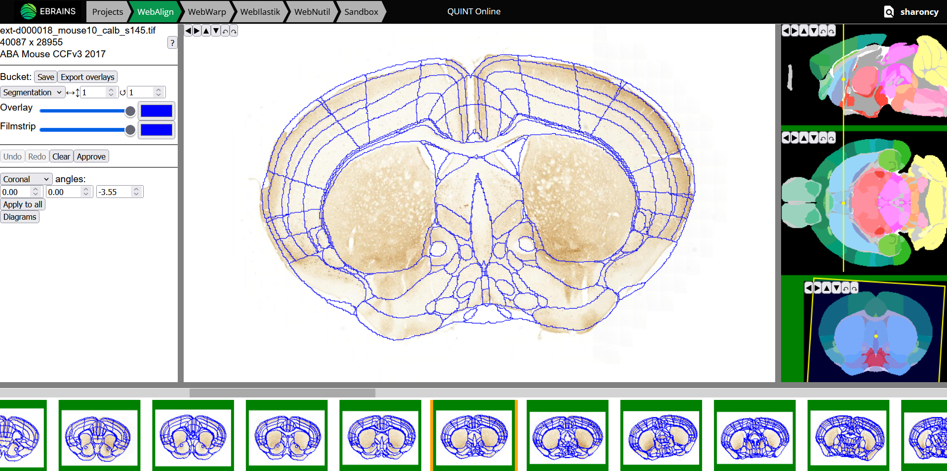 _images/WebAlign_Calb.png
